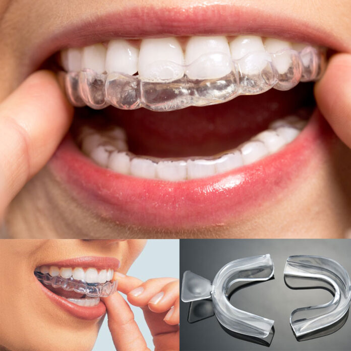 Teeth Whitening - Treatment, Cost And Benefits